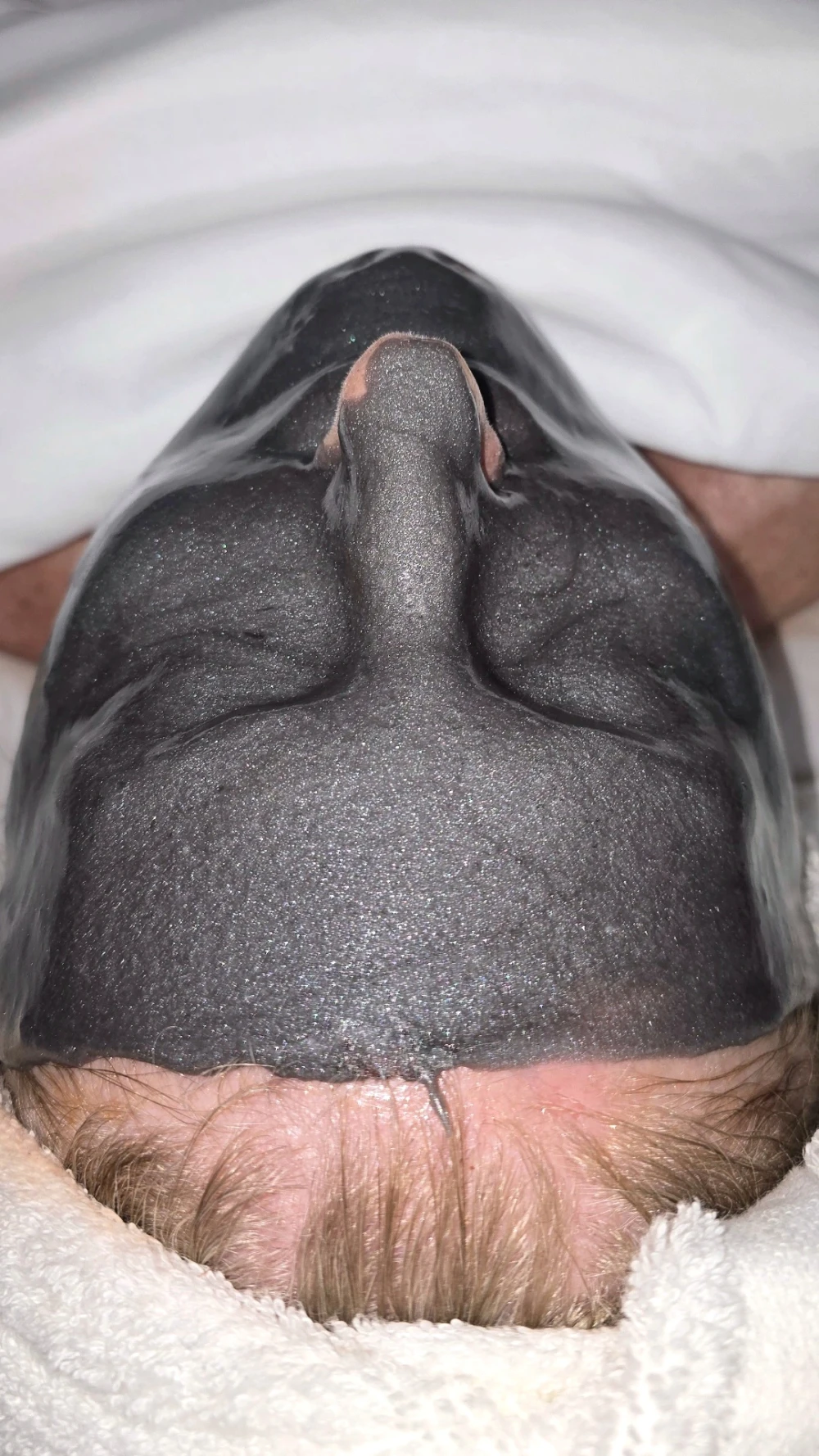 Cooling jelly mask applied after exfoliation to calm skin and reduce redness